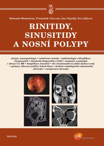 E-kniha Rinitidy, sinusitidy a nosní polypy - František Charvát, Jan Nejedlý, Eva Zýková, MUDr. Bohumil Markalous
