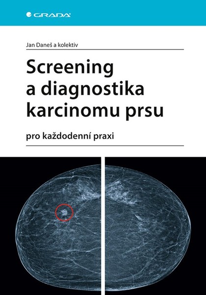 E-kniha Screening a diagnostika karcinomu prsu - kolektiv a, Jan Daneš