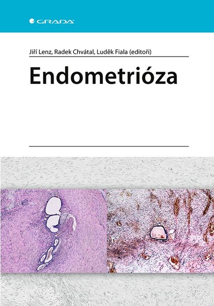 E-kniha Endometrióza - Jiří Lenz, Radek Chvátal, Luděk Fiala, kolektiv a