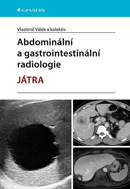 E-kniha Abdominální a gastrointestinální radiologie - kolektiv a, Vlastimil Válek