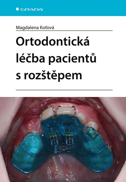 E-kniha Ortodontická léčba pacientů s rozštěpem - Magdalena Koťová