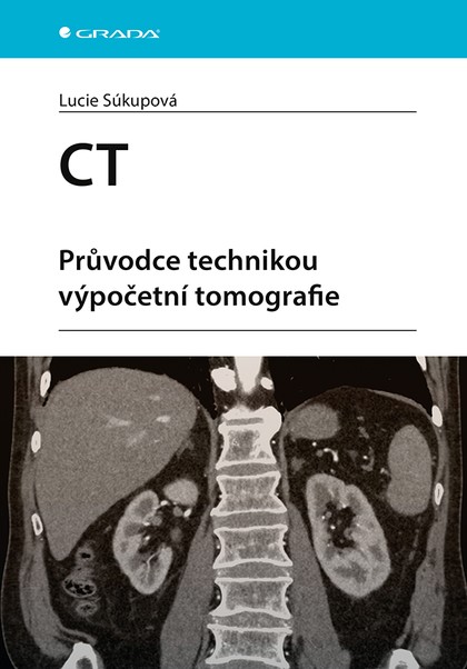 E-kniha CT - Průvodce technikou výpočetní tomografie - Lucie Súkupová